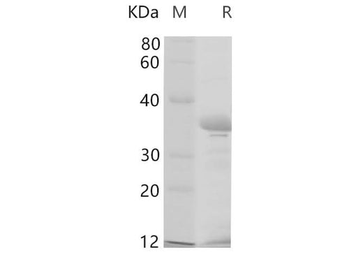 SDS-PAGE analysis of Human CDH1 proteins, 2 μg/lane of Recombinant Human CDH1 proteins was resolved with SDS-PAGE under reducing conditions, showing bands at 35 kDa.