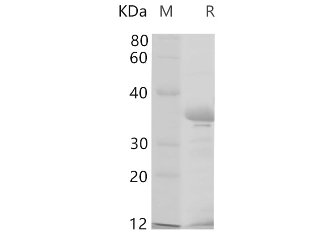 SDS-PAGE analysis of Human CDH1 proteins, 2 μg/lane of Recombinant Human CDH1 proteins was resolved with SDS-PAGE under reducing conditions, showing bands at 35 kDa.
