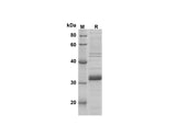 SDS-PAGE analysis of Mouse LY6G proteins, 2 μg/lane of Recombinant Mouse LY6G proteins was resolved with SDS-PAGE under reducing conditions, showing bands at 31 kDa.