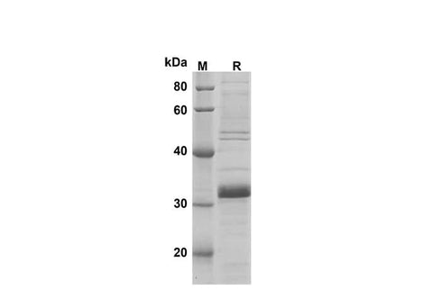 SDS-PAGE analysis of Mouse LY6G proteins, 2 μg/lane of Recombinant Mouse LY6G proteins was resolved with SDS-PAGE under reducing conditions, showing bands at 31 kDa.