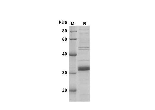 SDS-PAGE analysis of Mouse LY6G proteins, 2 μg/lane of Recombinant Mouse LY6G proteins was resolved with SDS-PAGE under reducing conditions, showing bands at 31 kDa.