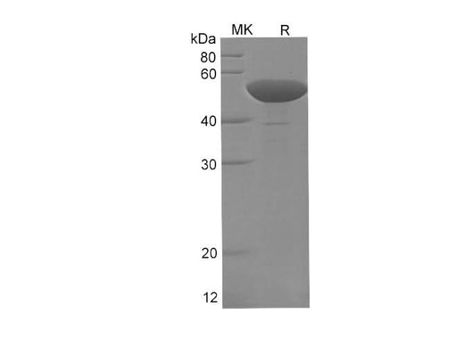 SDS-PAGE analysis of E.coli Glycerol kinase proteins, 2 μg/lane of Recombinant E.coli Glycerol kinase proteins was resolved with SDS-PAGE under reducing conditions, showing bands at 55-58 kDa.