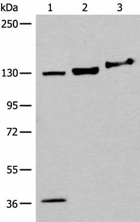 Western blot analysis of 293T cell Mouse brain tissue lysates using EPHA6 Polyclonal Antibody at dilution of 1:500
