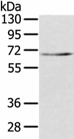Anti-Human/Mouse TBL1X Antibody - ABMIUM