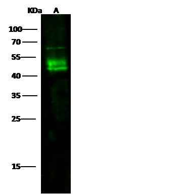 Anti-Human CD209 Antibody [A1293] - ABMIUM