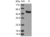 Recombinant Human IRAK4/IRAK-4 Protein (His Tag) - ABMIUM