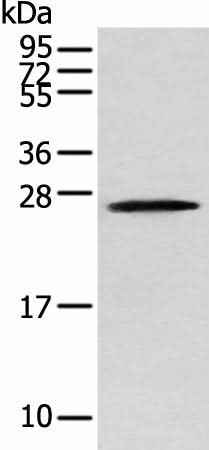 Anti-Human/Mouse TPPP Antibody