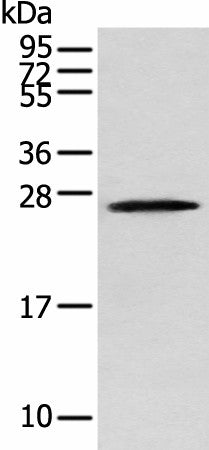 Western blot analysis of Human fetal brain tissue using TPPP Polyclonal Antibody at dilution of 1:250