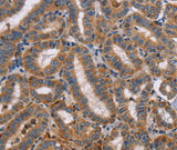 Anti-Human TLR8 Antibody - ABMIUM