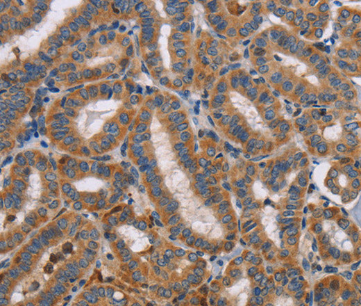 Anti-Human TLR8 Antibody - ABMIUM
