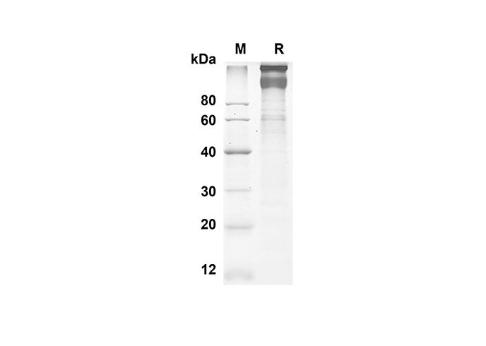 SDS-PAGE analysis of Human LEPR proteins, 2 μg/lane of Recombinant Human LEPR proteins was resolved with an SDS-PAGE under reducing conditions, showing bands at 89.8 kDa.