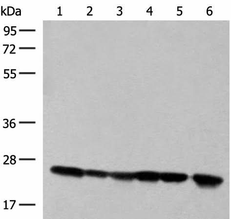 Western blot analysis of 293T cell and Human fetal liver tissue lysates using DTYMK Polyclonal Antibody at dilution of 1:550