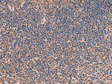 Immunohistochemistry of paraffin-embedded Human tonsil tissue using ITIH4 Polyclonal Antibody at dilution of 1:30(×200)