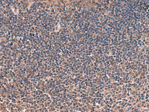 Immunohistochemistry of paraffin-embedded Human tonsil tissue using ITIH4 Polyclonal Antibody at dilution of 1:30(×200)