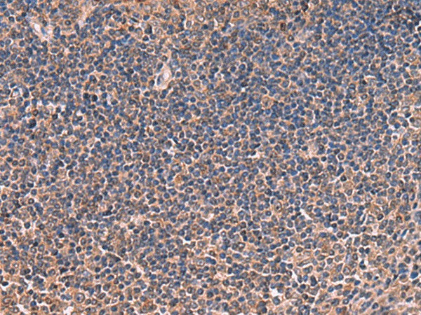 Immunohistochemistry of paraffin-embedded Human tonsil tissue using ITIH4 Polyclonal Antibody at dilution of 1:30(×200)