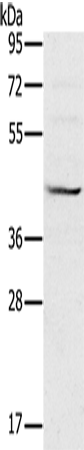 Anti-Human/Mouse/Rat MVK Antibody - ABMIUM