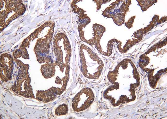 Anti-Human/Mouse/Rat ANXA5 Antibody [B1023]