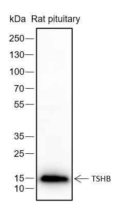 Anti-Human/Rat TSHB Antibody [A117] - ABMIUM