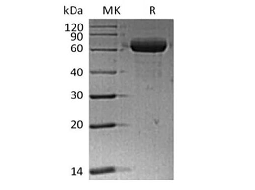 Recombinant Human Sialic acid-binding Ig-like lectin 15/Siglec-15/CD33L3 (C-Fc) - ABMIUM