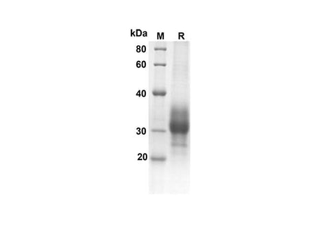 SDS-PAGE analysis of Human TNFRSF9 proteins, 2 μg/lane of Recombinant Human TNFRSF9 proteins was resolved with an SDS-PAGE under reducing conditions, showing bands at 17.8 kDa.