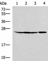 Western blot analysis of HT29 A549 Hela and LOVO cell lysates using RPL13A Polyclonal Antibody at dilution of 1:1000