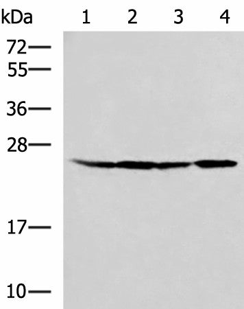Western blot analysis of HT29 A549 Hela and LOVO cell lysates using RPL13A Polyclonal Antibody at dilution of 1:1000