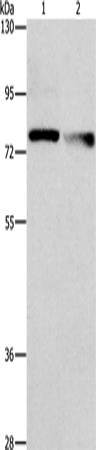Anti-Human NEK11 Antibody - ABMIUM