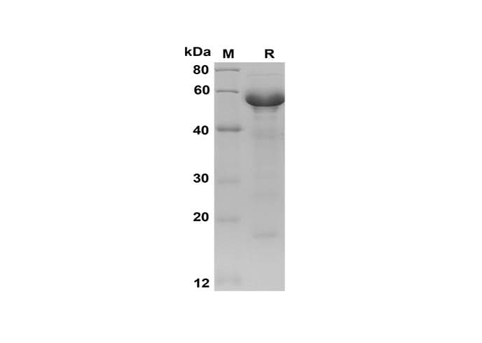 SDS-PAGE analysis of Human BAG3 proteins, 2 μg/lane of Recombinant Human BAG3 proteins was resolved with SDS-PAGE under reducing conditions, showing bands at 70 kDa.