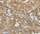 Anti-Human/Mouse PKD1 Antibody - ABMIUM