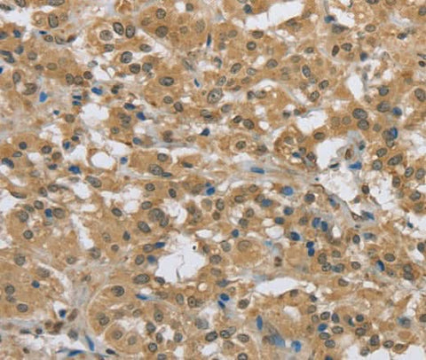 Anti-Human/Mouse PKD1 Antibody - ABMIUM