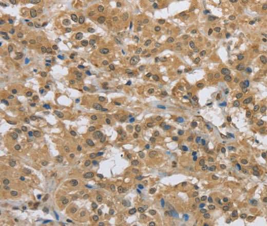 Anti-Human/Mouse PKD1 Antibody - ABMIUM