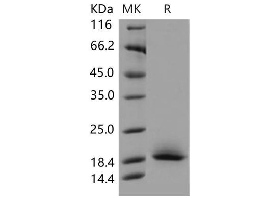 > 92 % as determined by reducing SDS-PAGE.