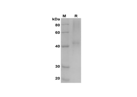 SDS-PAGE analysis of Human Biglycan/BGN proteins, 2 μg/lane of Recombinant Human Biglycan/BGN proteins was resolved with SDS-PAGE under reducing conditions, showing bands at 42 kDa.