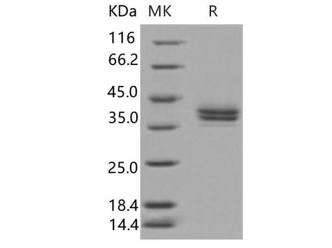 Recombinant Human CADM3 Protein (His Tag) - ABMIUM