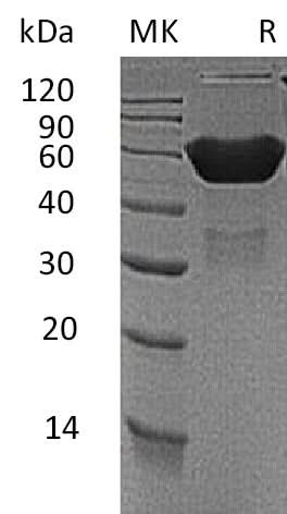 Recombinant Mouse CXADR/CAR Protein (Fc Tag) - ABMIUM