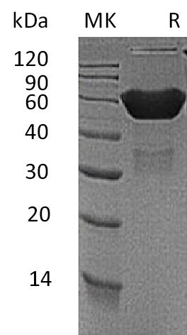 Recombinant Mouse CXADR/CAR Protein (Fc Tag) - ABMIUM