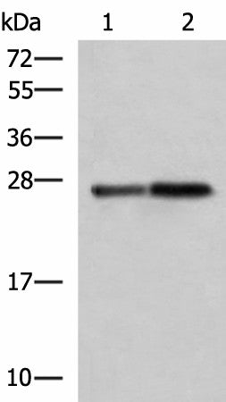Western blot analysis of Mouse pancreas tissue and Rat pancreas tissue lysates using CTRB1 Polyclonal Antibody at dilution of 1:1000