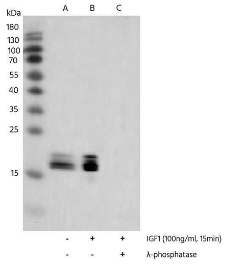 Anti-Human EIF4EBP1 Antibody [A1159] - ABMIUM
