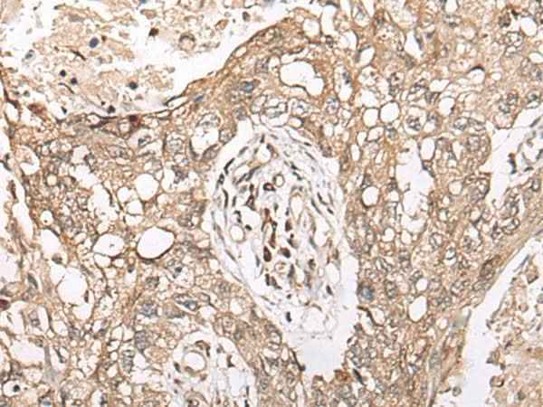 Anti-Human M1AP Antibody