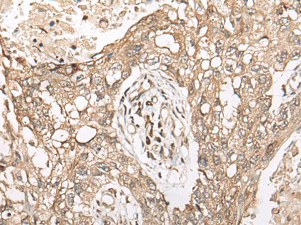 Anti-Human M1AP Antibody - ABMIUM