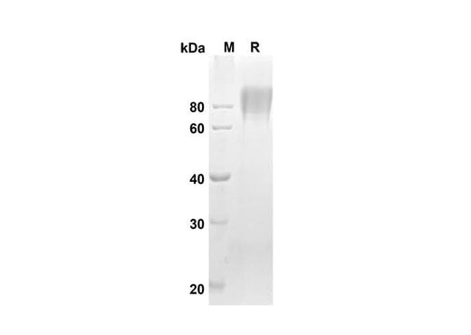 SDS-PAGE analysis of Human CD86 proteins, 2 μg/lane of Recombinant Human CD86 proteins was resolved with an SDS-PAGE under reducing conditions, showing bands at 49.5 kDa.