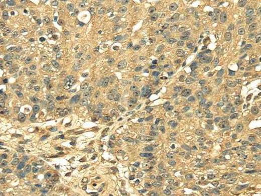 Anti-Human/Mouse/Rat RPS3 Antibody