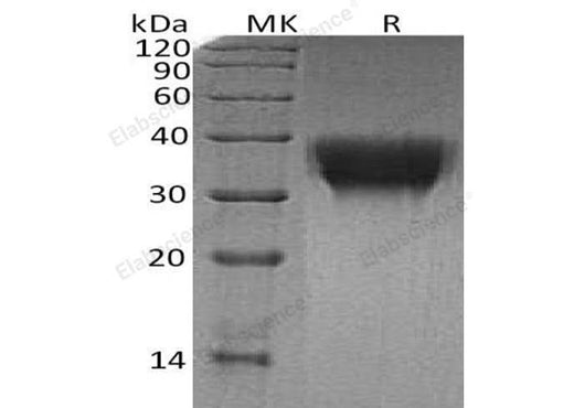 Recombinant Human TREM1 Protein (His Tag) - ABMIUM