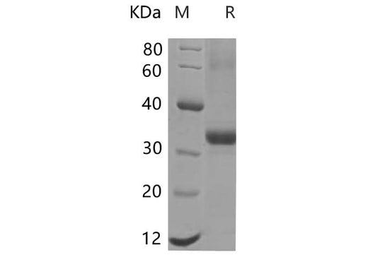 SDS-PAGE analysis of Mouse EpCAM proteins, 2 μg/lane of Recombinant Mouse EpCAM proteins was resolved with SDS-PAGE under reducing conditions, showing bands at 30 kDa.