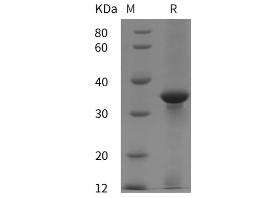 SDS-PAGE analysis of Human GAL proteins, 2 μg/lane of Recombinant Human GAL proteins was resolved with SDS-PAGE under reducing conditions, showing bands at 35 kDa.