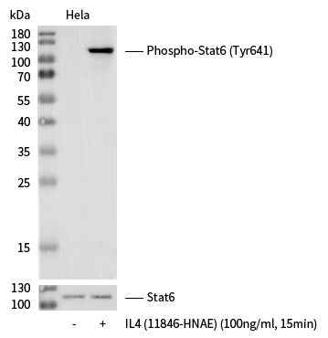 Anti-Human STAT6 Antibody [A1193] - ABMIUM
