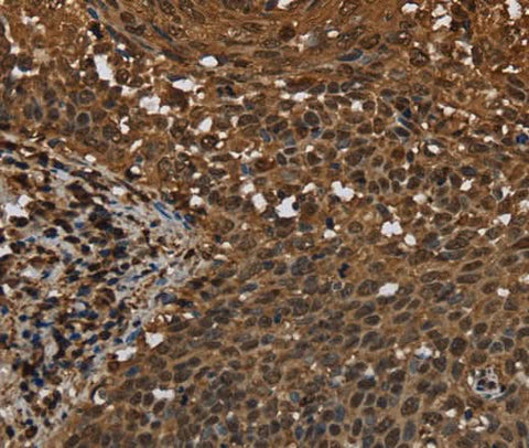 Anti-Human MYBBP1A Antibody - ABMIUM