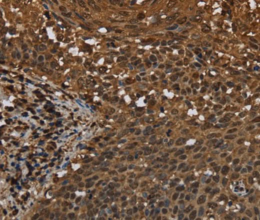 Anti-Human MYBBP1A Antibody - ABMIUM