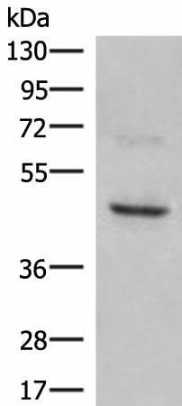 Western blot analysis of SKOV3 cell lysate using NCR1 Polyclonal Antibody at dilution of 1:350