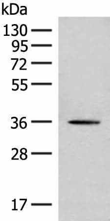 Anti-Human/Mouse/Rat MLST8 Antibody